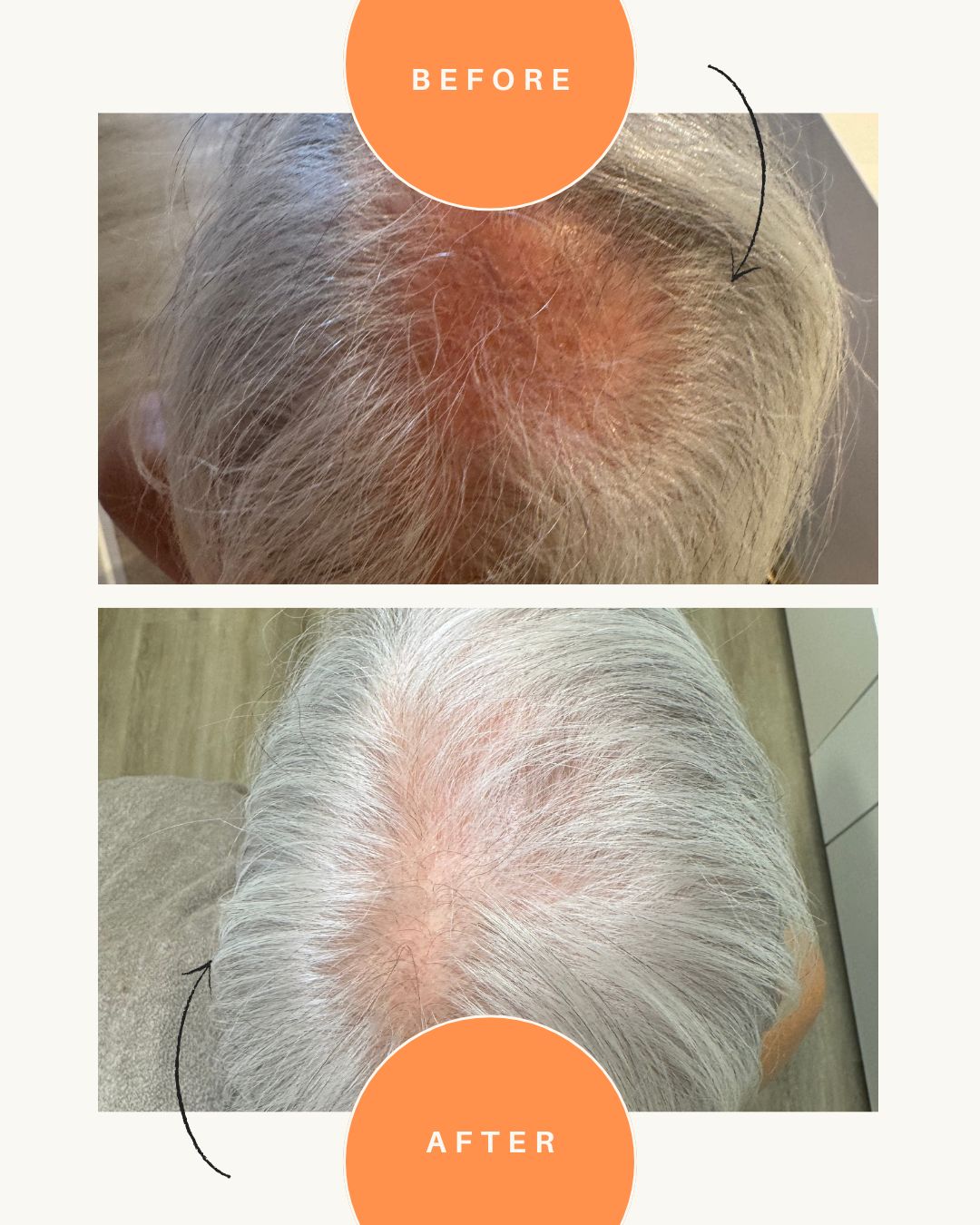 MIRIAM QUEVEDO | Hair Multiplying & Fortifying Intensive Mask