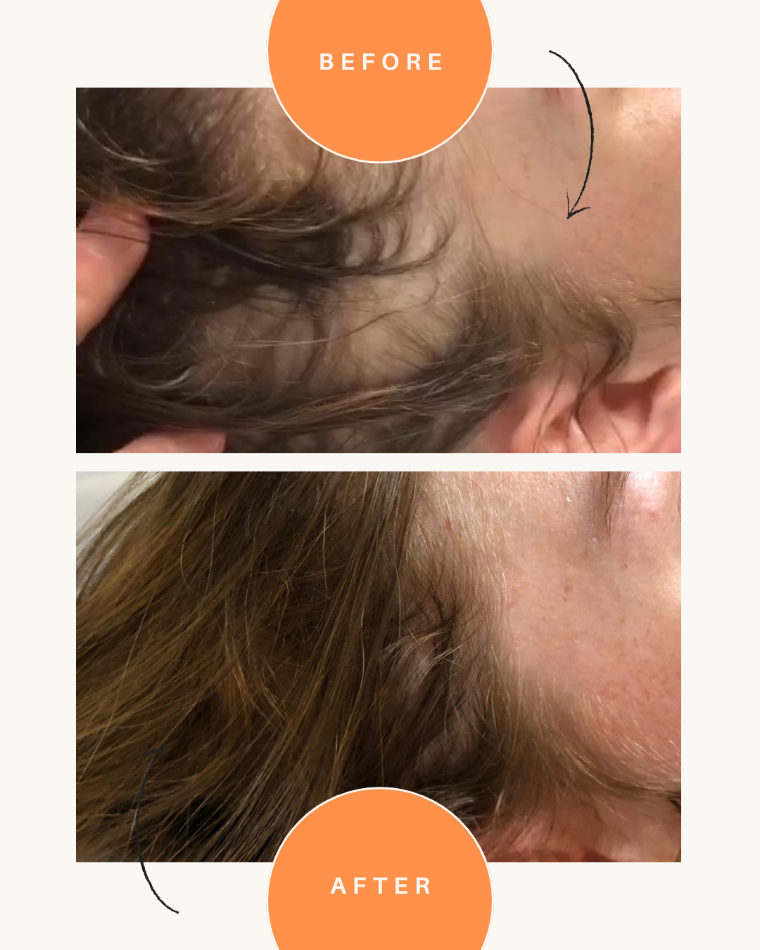 MIRIAM QUEVEDO | Black Baccara Hair Multiplying Intensive Shampoo